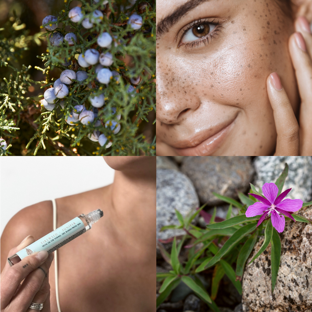 Skin Balancing Oil - Blemish Prone Skin