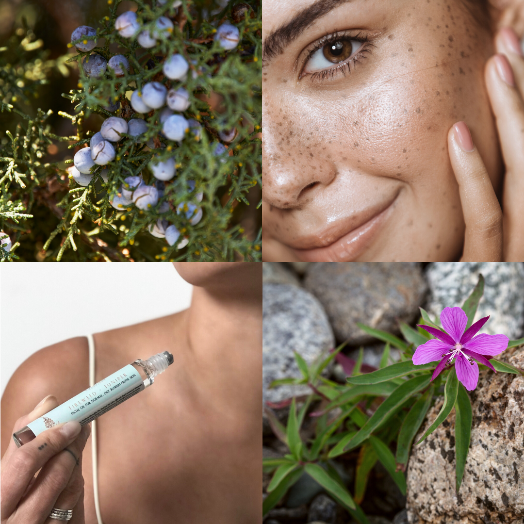 Skin Balancing Oil - Blemish Prone Skin